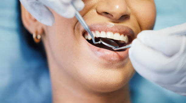 Best Emergency Gum Pain Relief  in La Croft, OH