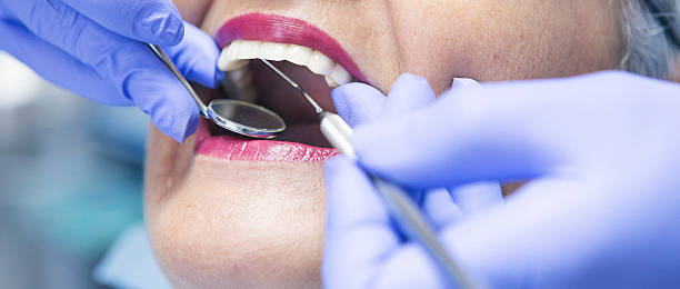Best Knocked-Out Tooth Emergency  in La Croft, OH